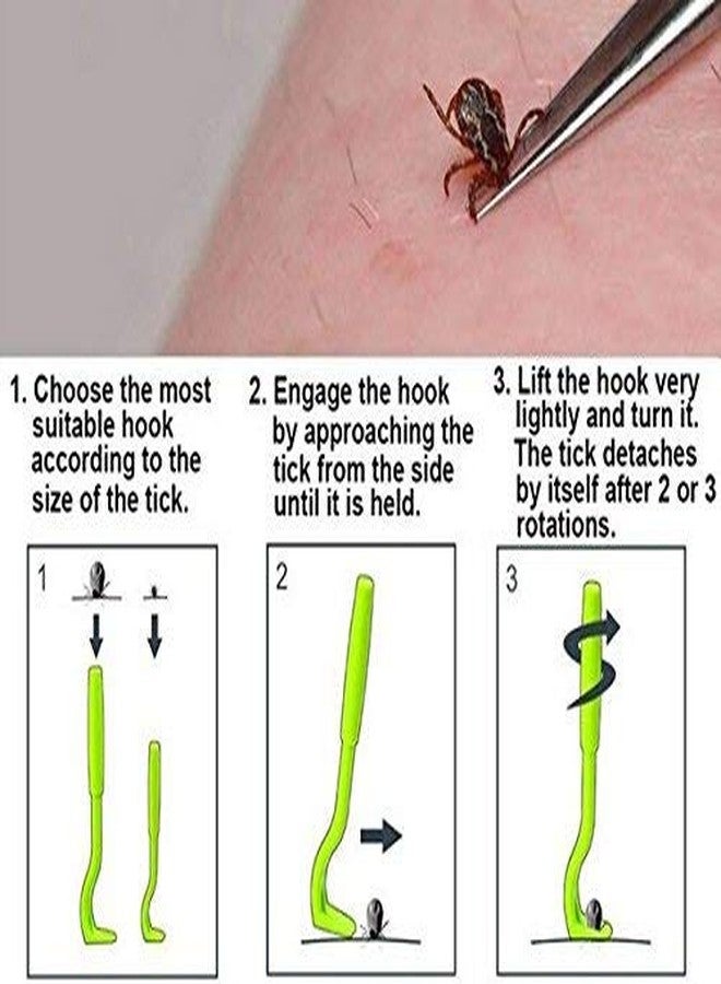 Sage Square Anti Tick Mite Remover Tweezer Twister r for Healthy Care of Dog Cat (Random Color) - Image 4